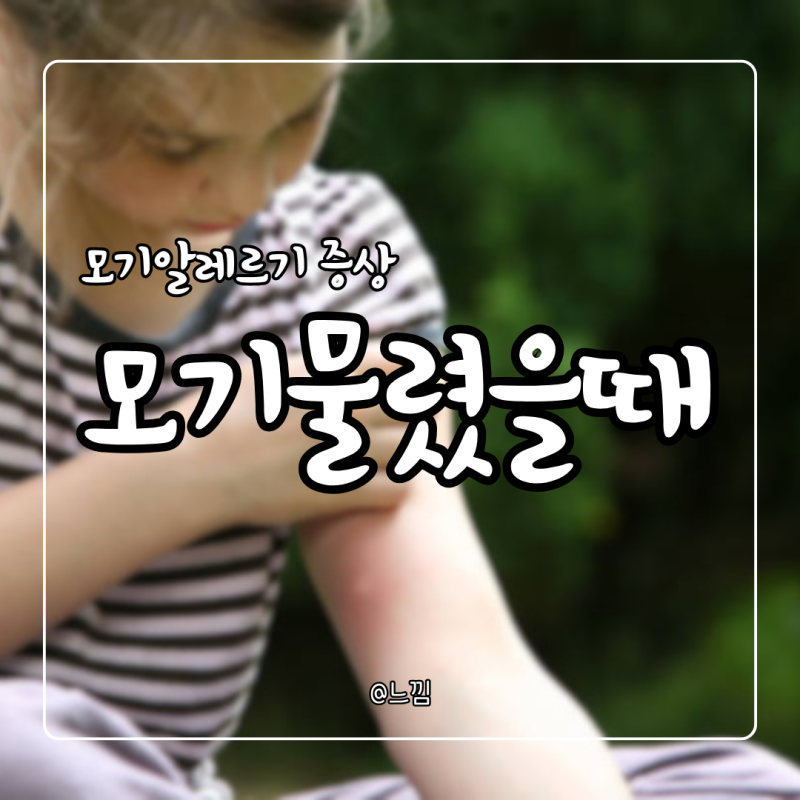 모기 물렸을때 연고(리도맥스, 에스로반) 모기알레르기