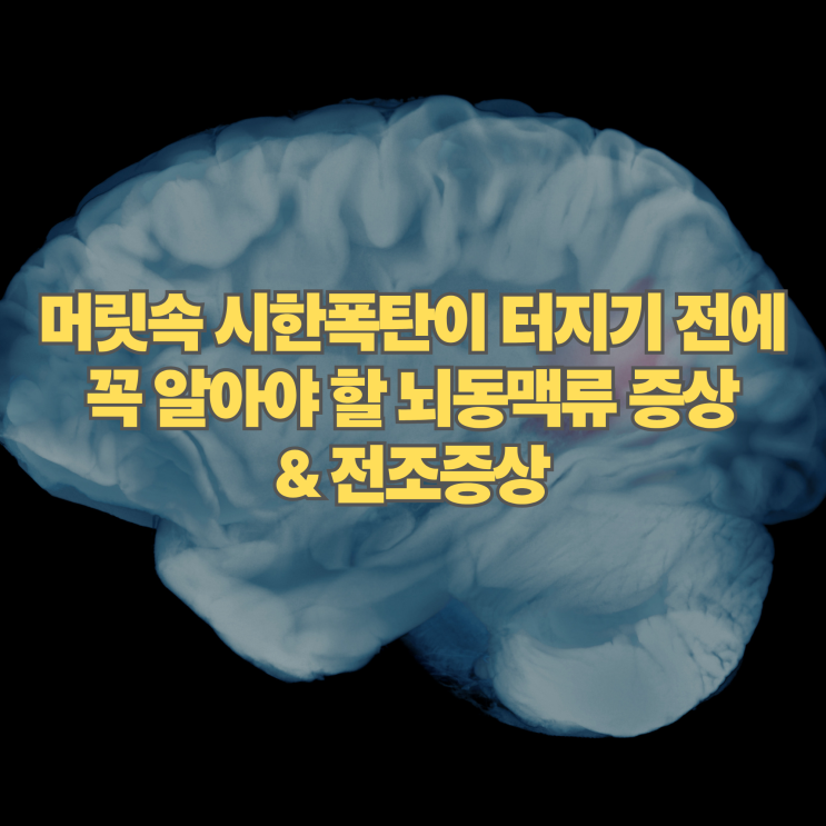  머릿속 시한폭탄, 터지기 전 알아야 할 뇌동맥류 증상 및 전조증상 정리