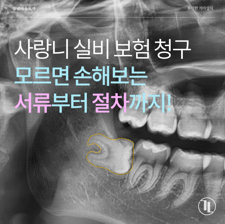 사랑니 발치 후 실비보험 청구 안 하면 손해! / 실비 보험금 얼마나 받을 수 있을까? / 청구 방....