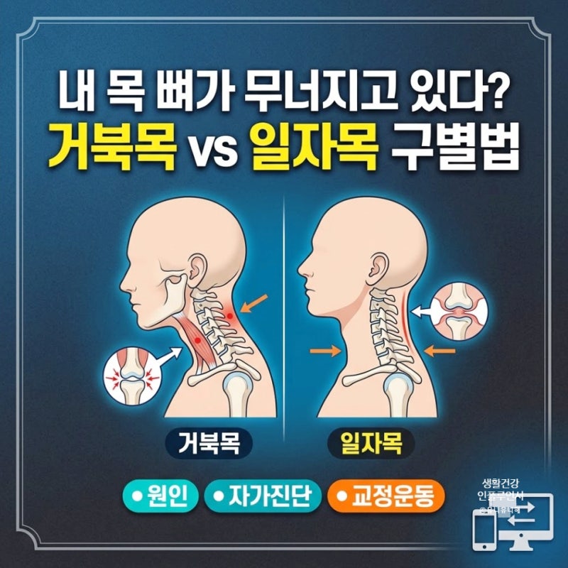 거북목 일자목 차이와 원인부터 자가진단, 거북목 교정운동법까지