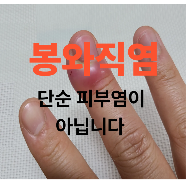  봉와직염 단순 피부염이 아닙니다  초기 치료가 중요한 이유