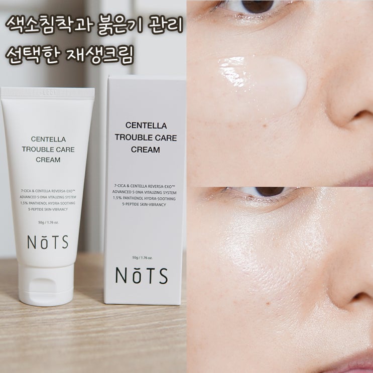  색소침착과 붉은기 관리로 선택한 재생크림