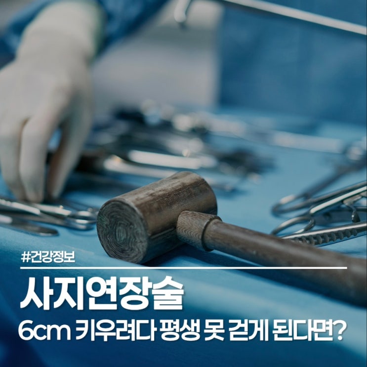  사지연장술로 6cm 가능? 허경환도 고민했던 키 크는 수술의 현실