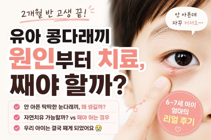 유아 콩다래끼 원인, 안 아픈 딱딱한 눈다래끼 째야 할까? 자연치유 가능할까?