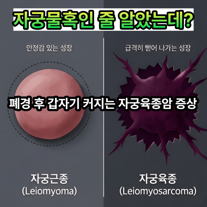 폐경 후 갑자기 자궁 혹이 커졌다면? 자궁 육종암 초기 증상 3가지와 감별 법