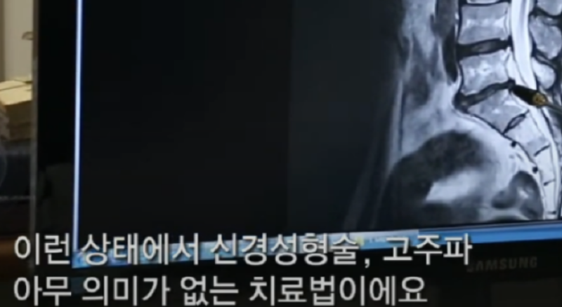 경추전만수면 방법