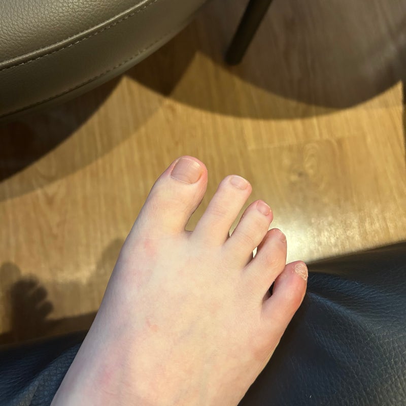 디톡신정 후기│통풍환자의 요산수치 변화 일지