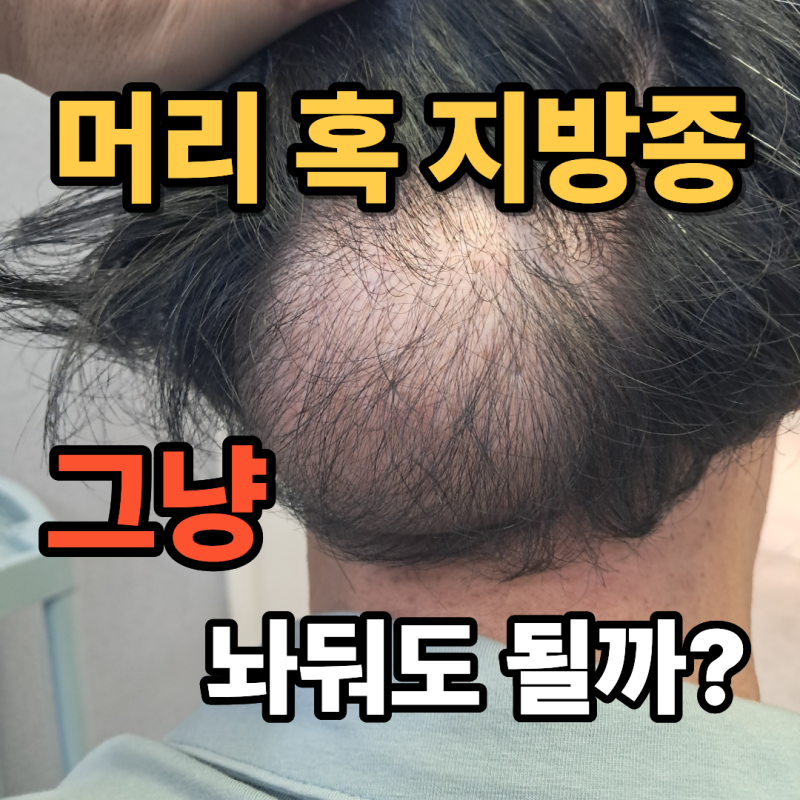 머리에 혹이 생겼는데… 그냥 놔둬도 될까요?