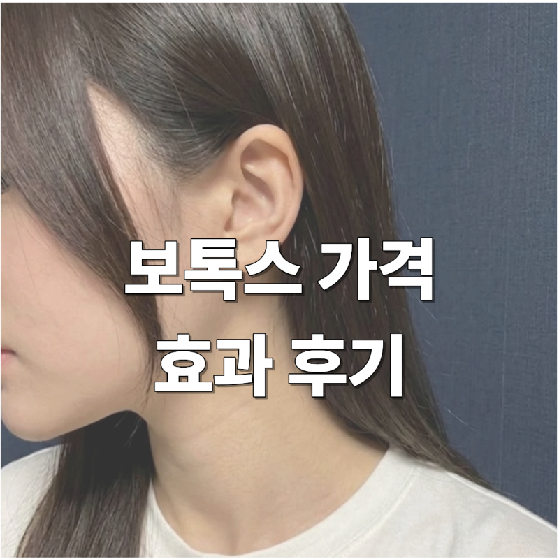2026년 사각턱 침샘 승모근 종아리 보톡스 가격 후기 효과 총정리 (국산 vs 수입)