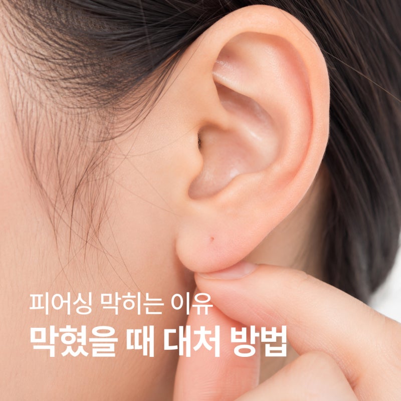 피어싱 빼면 언제 막힐까? 귀 막혔을 때 대처 방법 정리