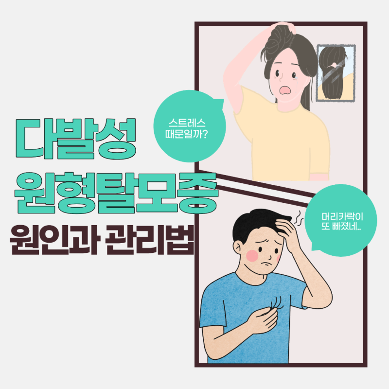 다발성 원형탈모증 증상과 치료법, 방치하면 어떻게 될까?