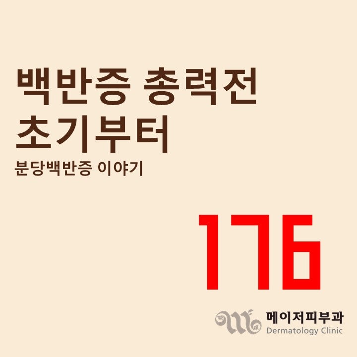 [백반증 이야기-176] 백반증, 발병 초기부터모든 수단을 동원해야, 분당 백반증 메이저피부과