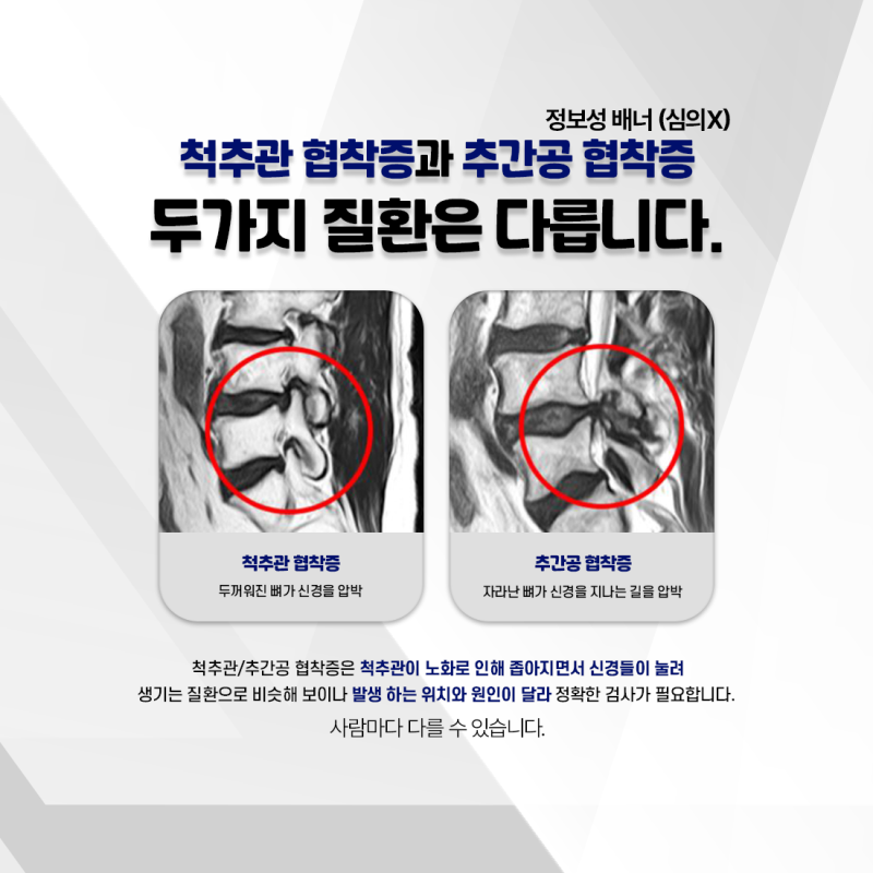 전주서신동협착증 전주우리병원, 이런 증상이 있다면 확인해 보세요
