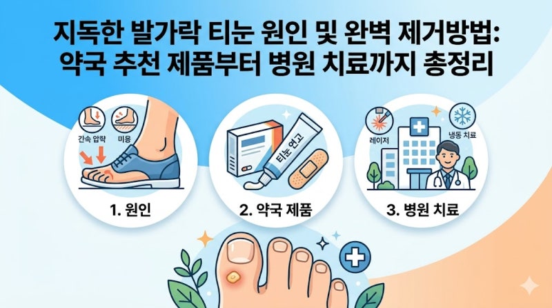지독한 발가락 티눈 원인 및 완벽 제거방법: 약국 추천 제품부터 병원 치료까지 총정리