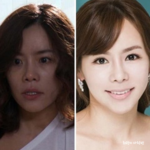 "양악수술 후 비호감.. 연기 활동 못 해.." 성형수술로 개성잃고 연예계에서 사라진 톱여배우....