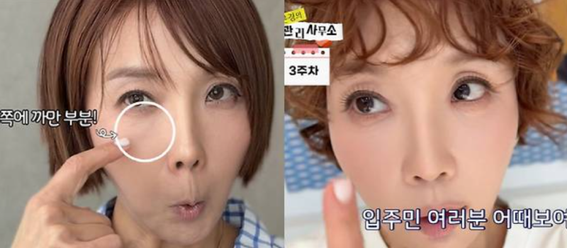 최은경, 눈 밑 지방재배치 후 확 달라진 얼굴..."동안 인상"