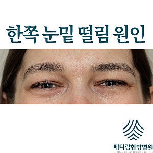 한쪽 눈밑 떨림 원인 병원 가야할 때는?