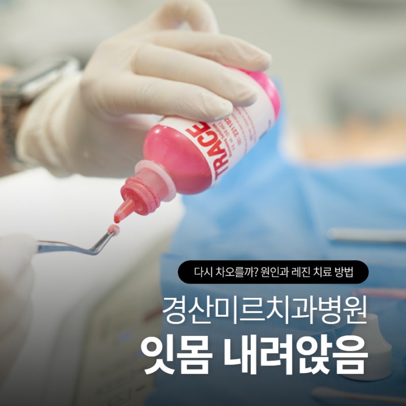 잇몸 내려앉음 다시 차오를까? 원인과 레진 치료 방법