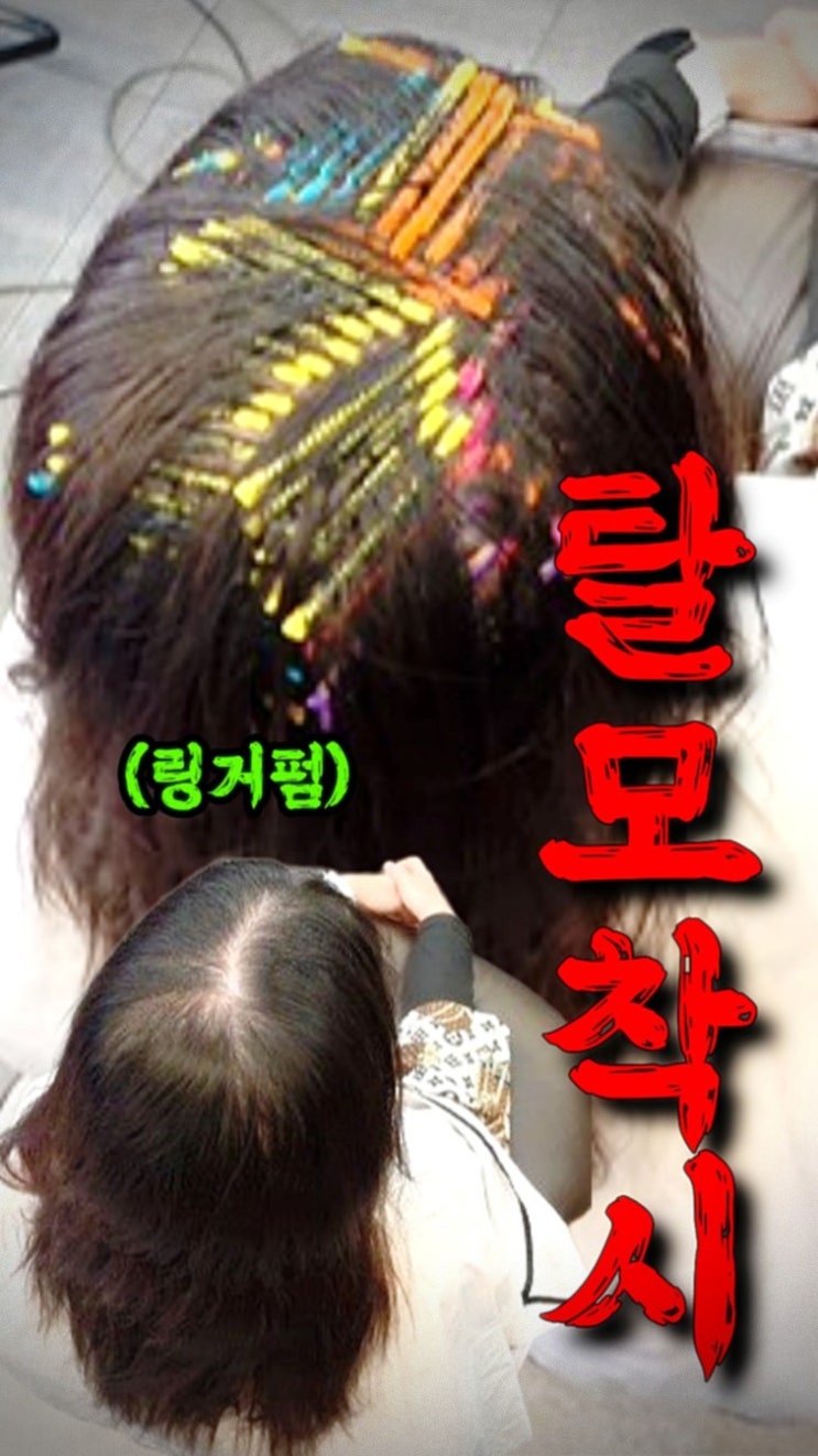  여자 긴머리 정수리 갈라짐 고민, 화성 고객님 모류교정 링거펌으로 양갈래 가르마 해결!