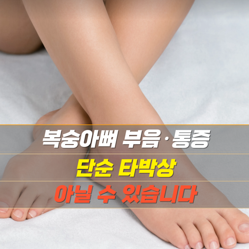 복숭아뼈 부음·통증, 단순 타박상 아닐 수 있습니다