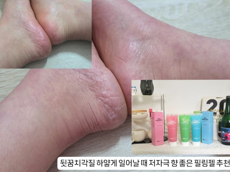  뒷꿈치각질 하얗게 일어날 때 저자극 향 좋은 필링젤 추천