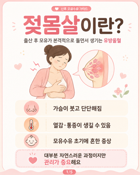 출산 3일째 몸살인 줄 알았는데, 알고 보니 젖몸살이었습니다