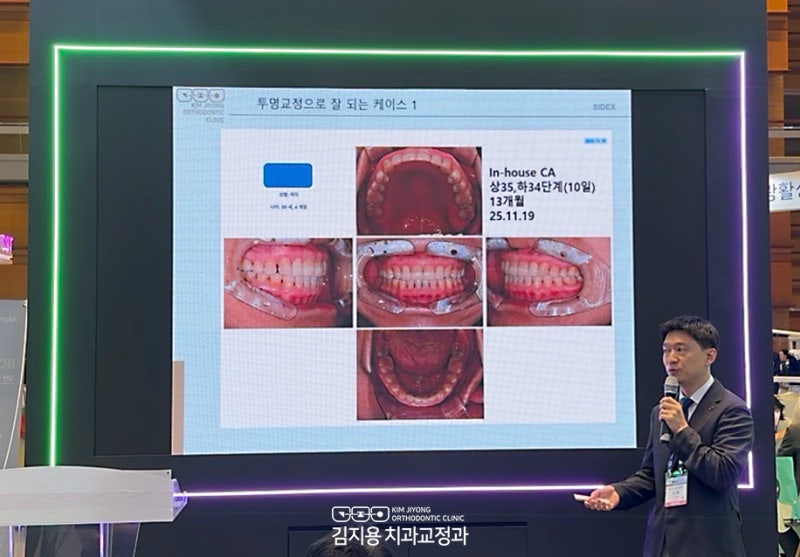 김지용치과교정과치과 SIDEX 2026에서 발표를 했습니다