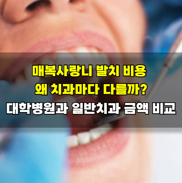 매복사랑니 발치 비용 왜 치과마다 다를까? 대학병원과 일반치과 금액 비교