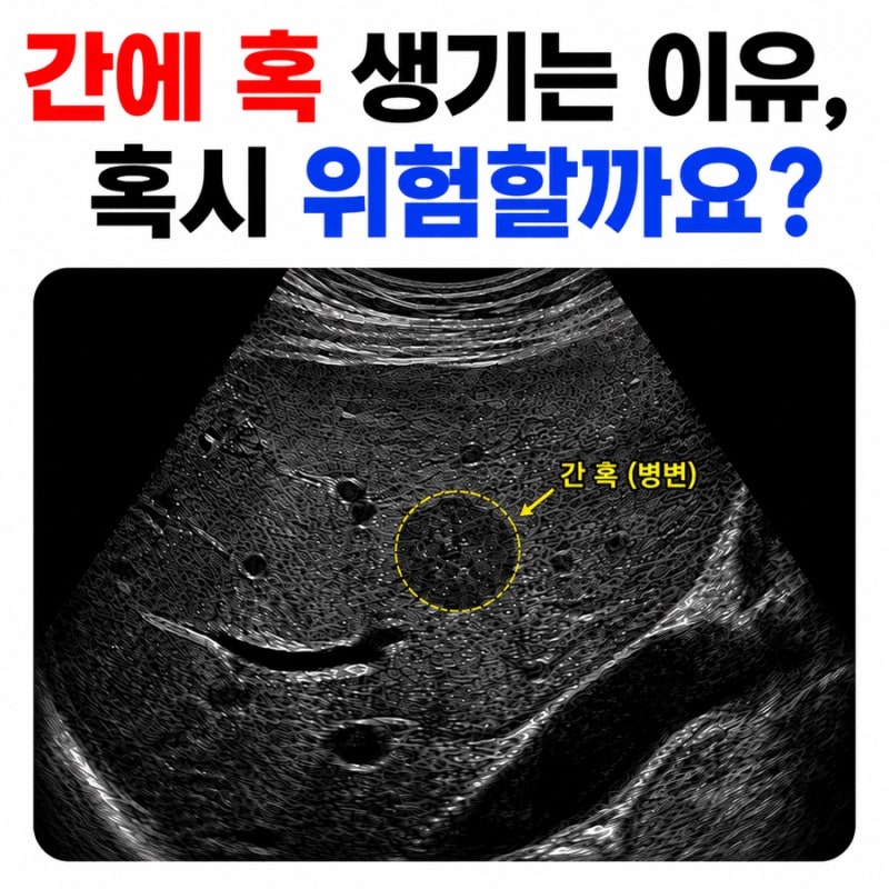 간에 혹 생기는 이유 혹시 위험할까요?