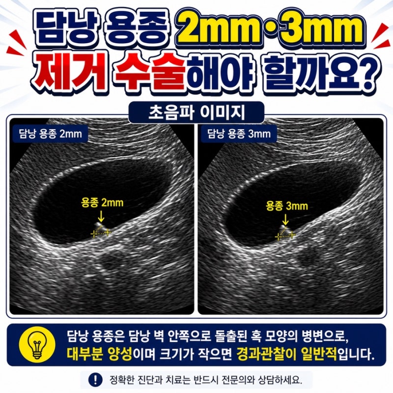 담낭 용종 2mm 3mm 제거 수술해야 할까요?