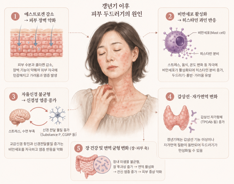 갱년기 만성 두드러기가 단순 알레르기 치료, 항히스타민제로 안된다면?