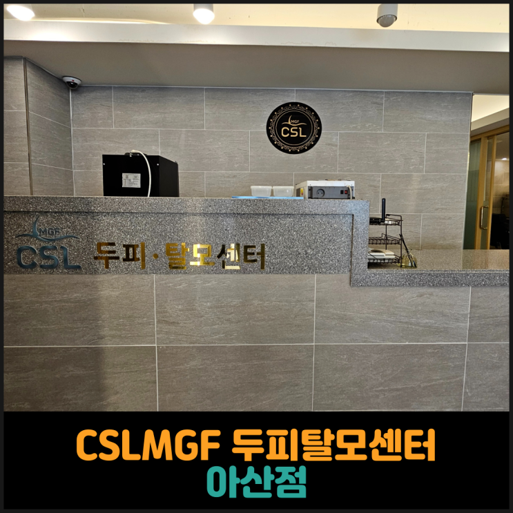  CSLMGF 두피탈모센터 아산점, 두피크리닉 후기
