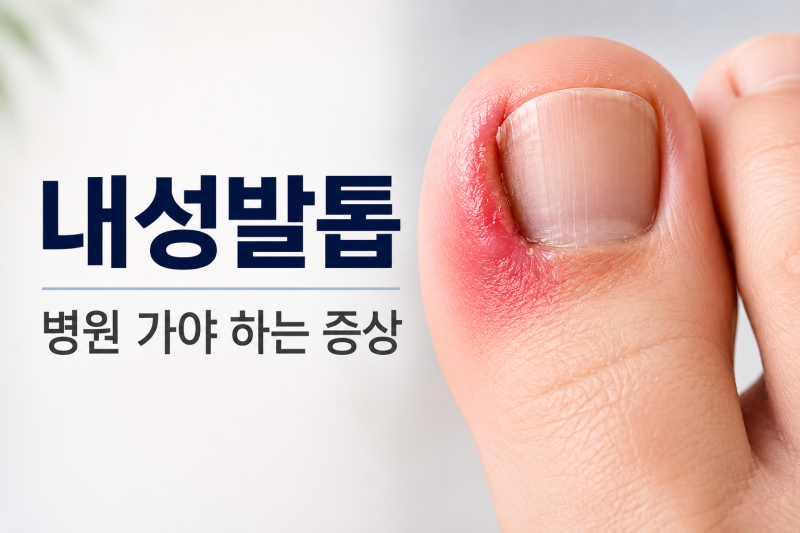 내성발톱 치료 방법 총정리｜병원 가야 하는 증상과 자가치료 기준