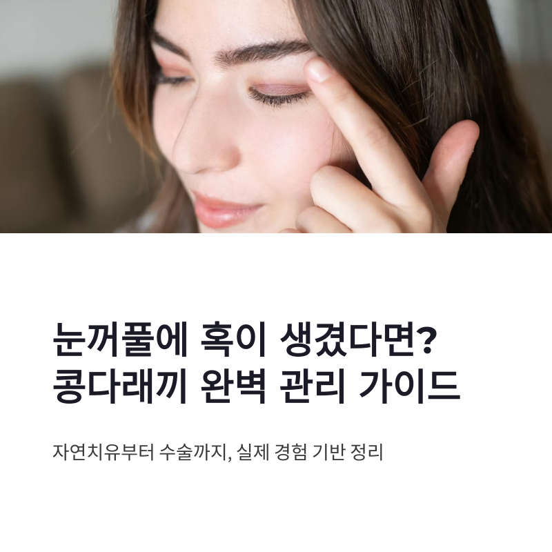 콩다래끼 자연치유 가능할까? 눈콩다래끼 관리법과 대처 방법 정리