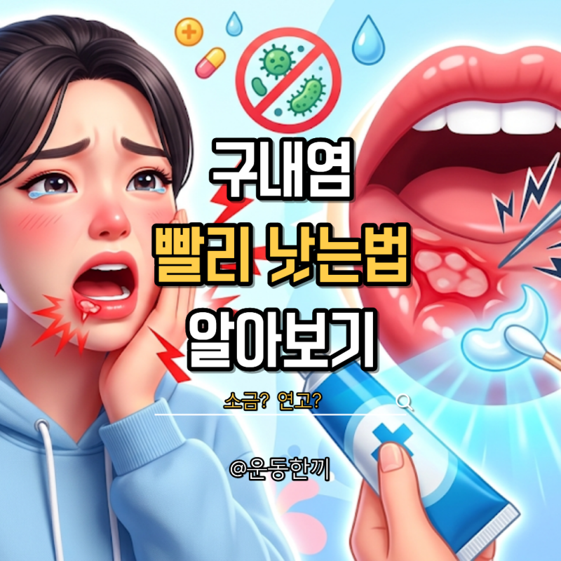 구내염 빨리 낫는법 기간 소금 음식