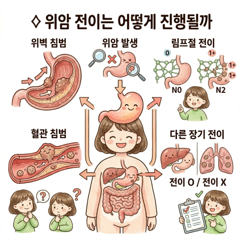 위암 전이 경로와 전이 증상 정리