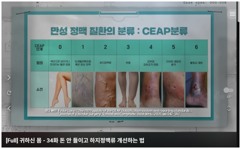 하지정맥류 3주의 기적.귀하신 몸- 돈 안 들이는 하지정맥류 자기 관리 가이드