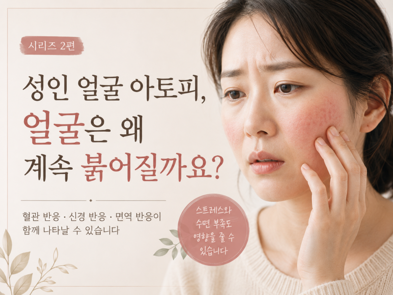 성인 얼굴 아토피 #2