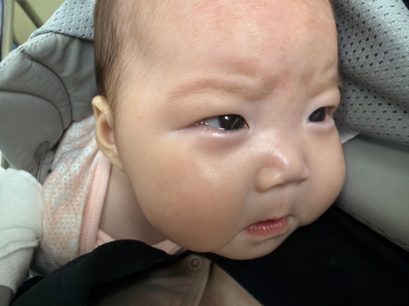 2개월 신생아 가와사키 완치 기록 6: 가와사키 재발 3차 치료