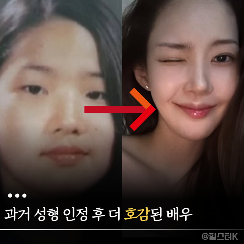 "과거 성형 전 사진 퍼졌는데" 반전, 박민영이 호감 배우 된 진짜 이유(연예이슈)