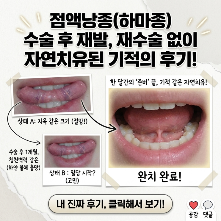  점액낭종 수술 후 한 달 만에 재발? 병원 가기 전 꼭 알아야 할 자연치유 반전 후기