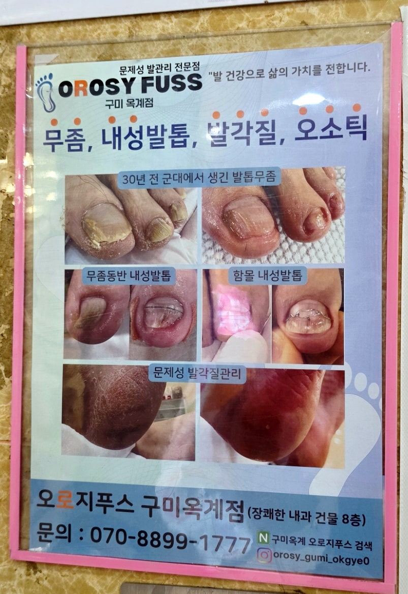 아르떼네일 사진 3