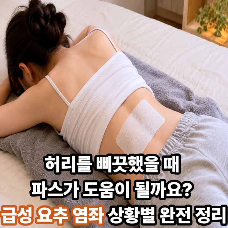 허리를 삐끗했을 때 파스가 도움이 될까요? 급성 요추 염좌 상황별 완전 정리