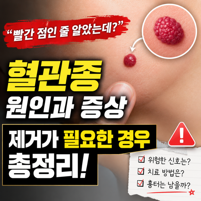 혈관종 원인과 증상, 제거가 필요한 경우 총정리