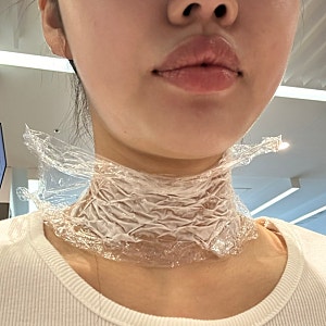 부산 이샘병원 갑상선 세침검사 2회차 검사결과 당일가능