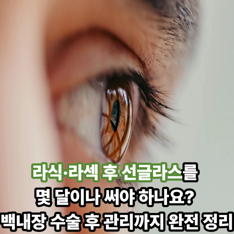 라식·라섹 후 선글라스를 몇 달이나 써야 하나요? 백내장 수술 후 관리까지 완전 정리