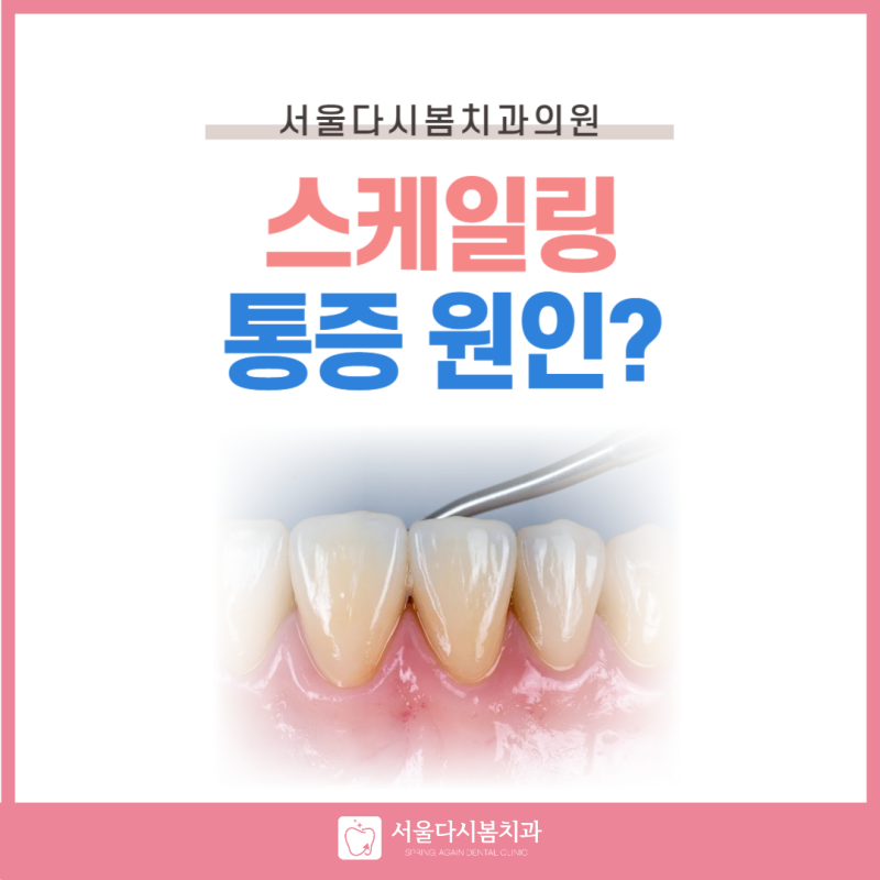 스케일링 통증 심한 이유 아픈 게 정상인가요?