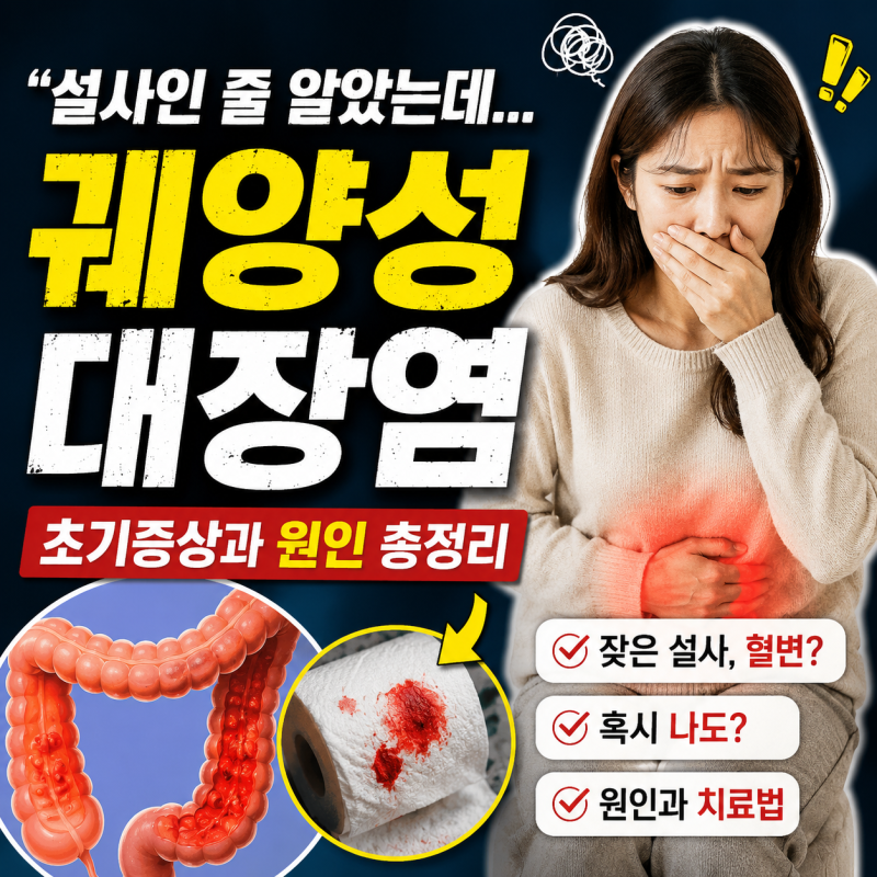 설사인 줄 알았는데… 궤양성대장염 초기증상과 원인 정리