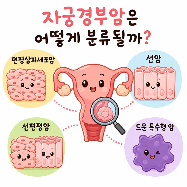 자궁경부암 종류 총정리 (HPV 관련형·선암·편평상피세포암 차이)