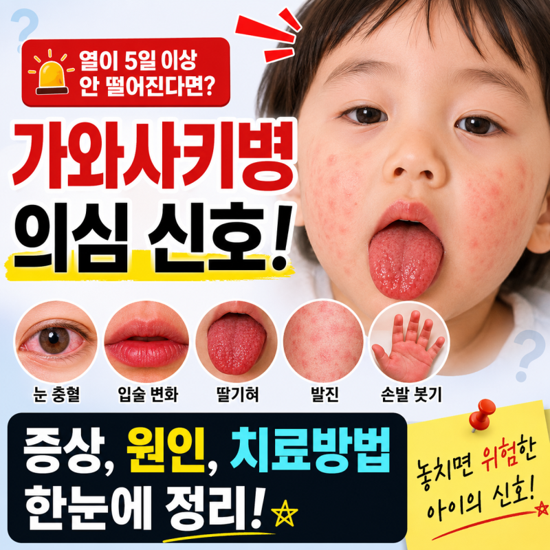 가와사키병 증상, 원인, 치료방법 한눈에 정리